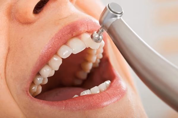 Dental Hygienist Cleaning Teeth.