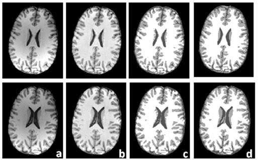 Hierarchical Transformers for Medical Image Classification