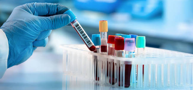 Low-Cost Diagnostics with AI-Assisted Analysis