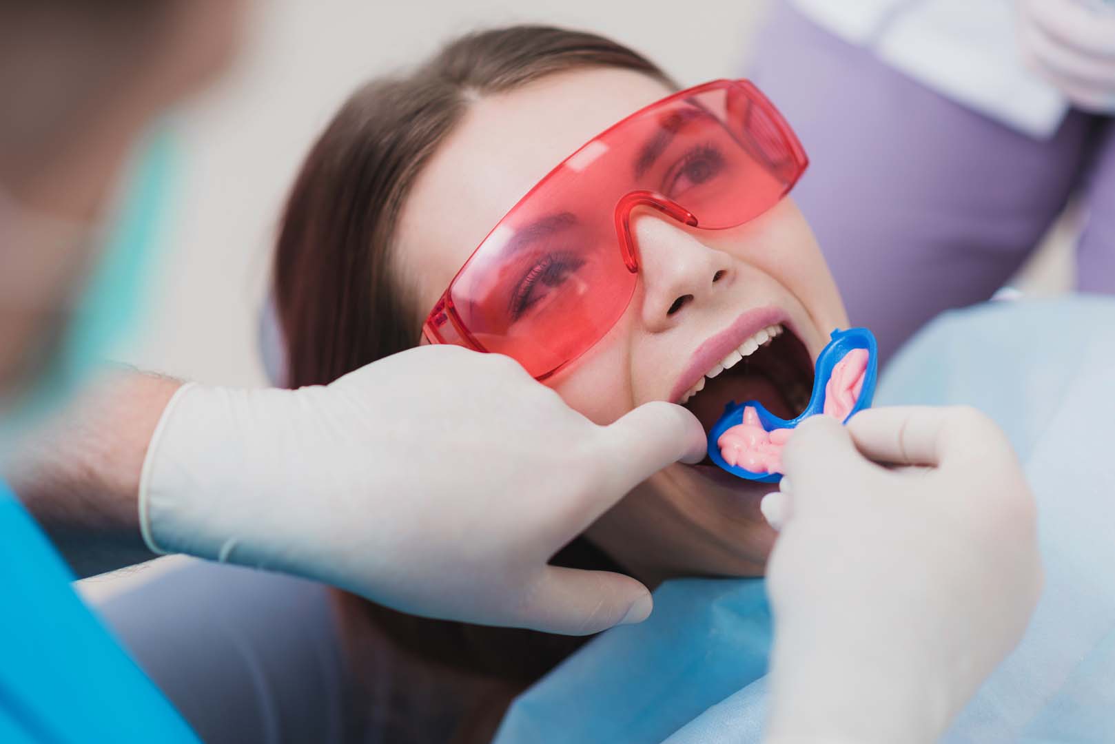 Fluoride Treatments