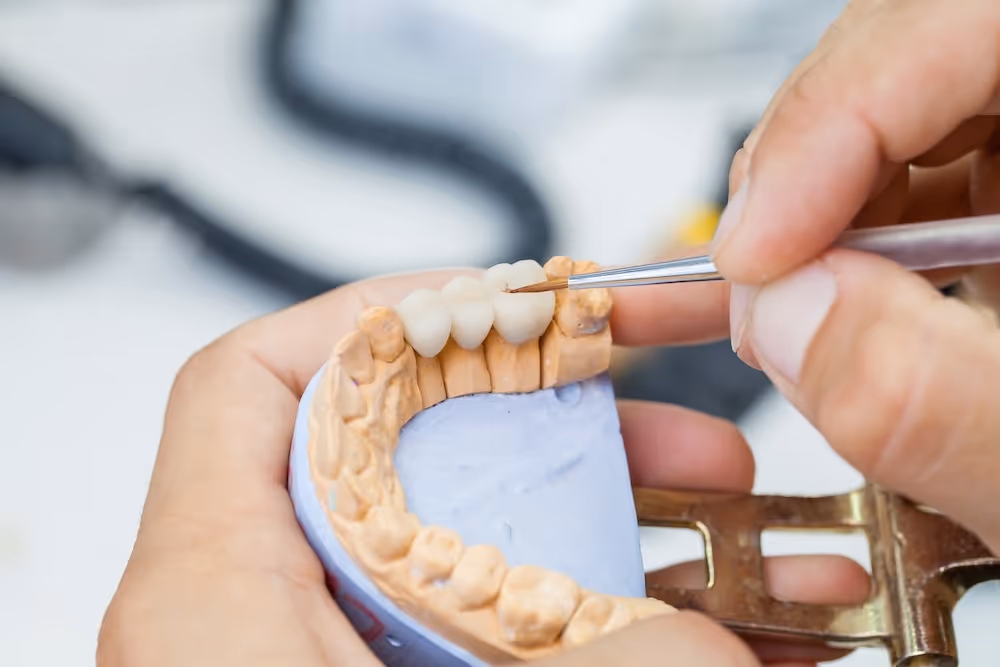 A person working on a dental bridge..