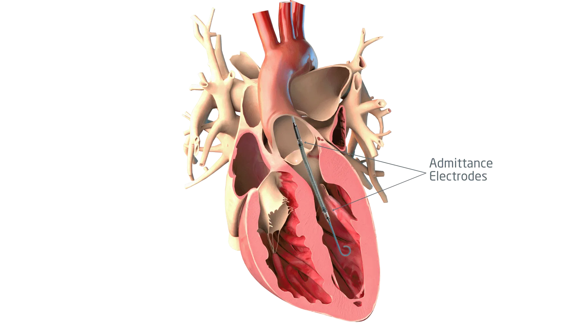 A graphic rendering of a human heart with an Admittance Percutaneous Ventricular Assist Device.