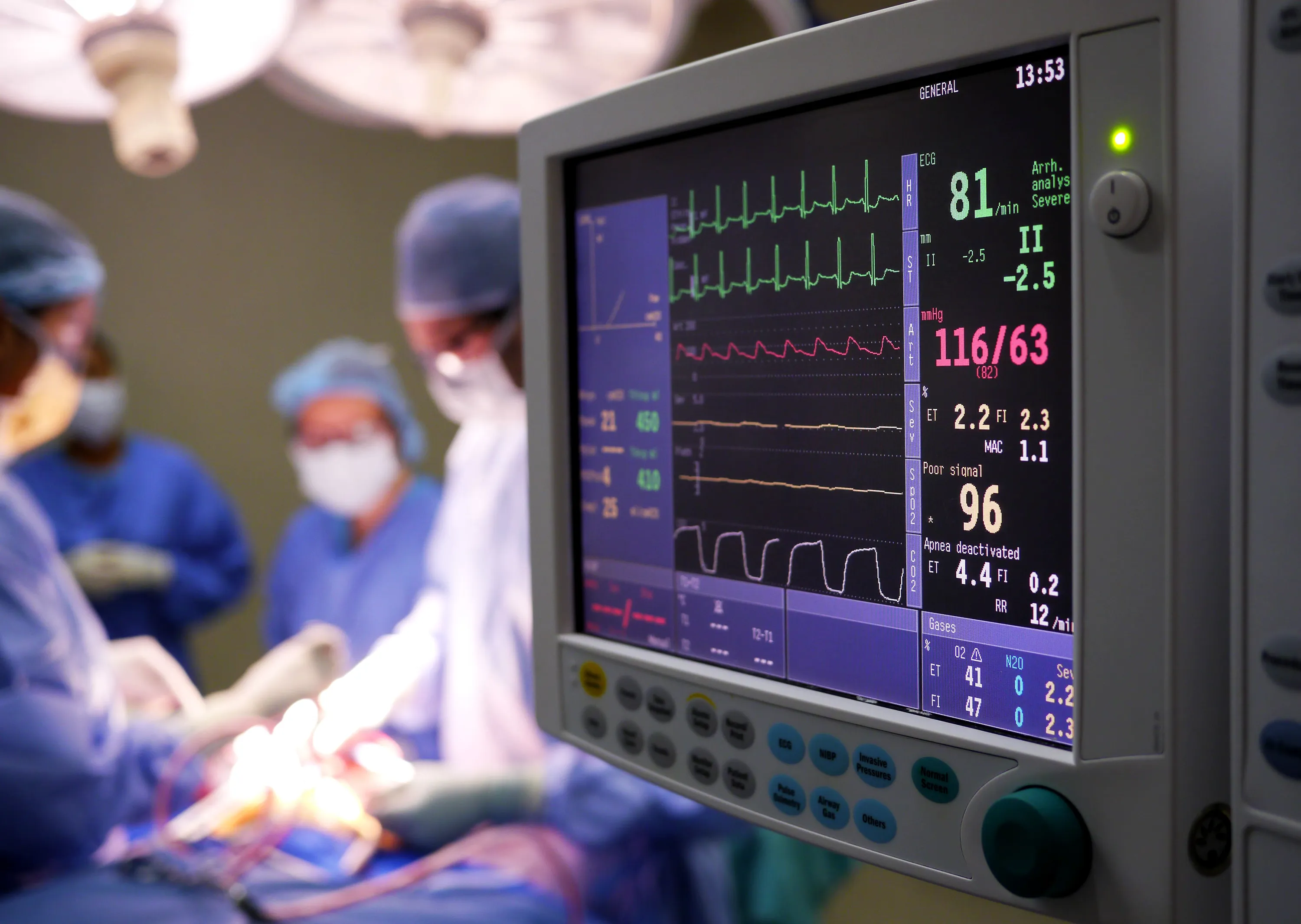 A vital signs monitor showing a patient’s vital signs during an operation.