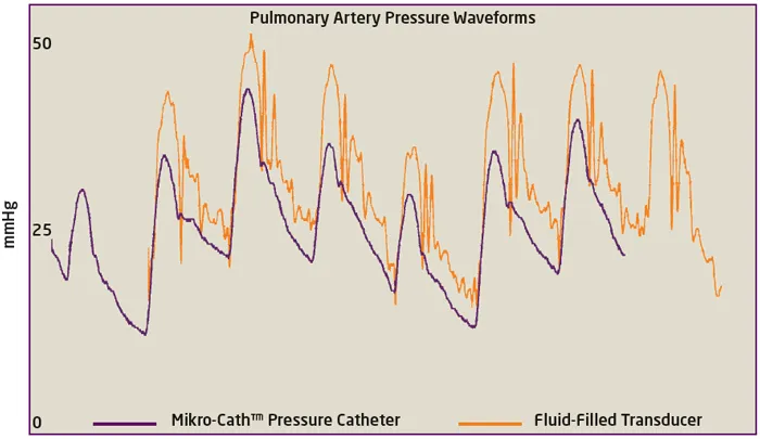 Pulmonary artery pressure waveforms.