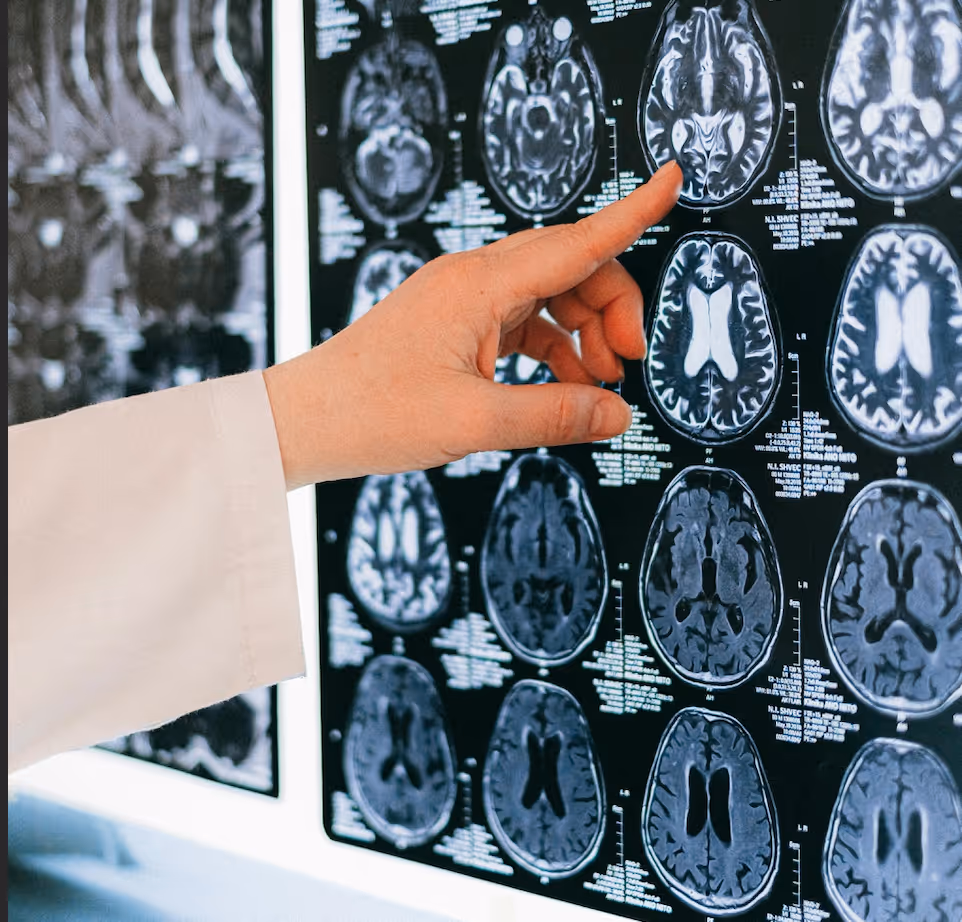 finger pointing to X-Ray scans