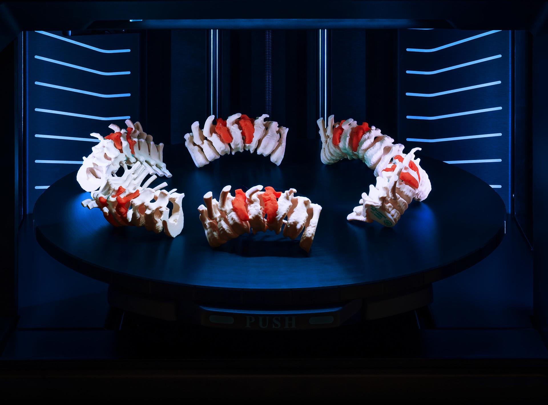 Three medical spine models with red-highlighted vertebrae displayed on a round dark surface inside a scanning device.