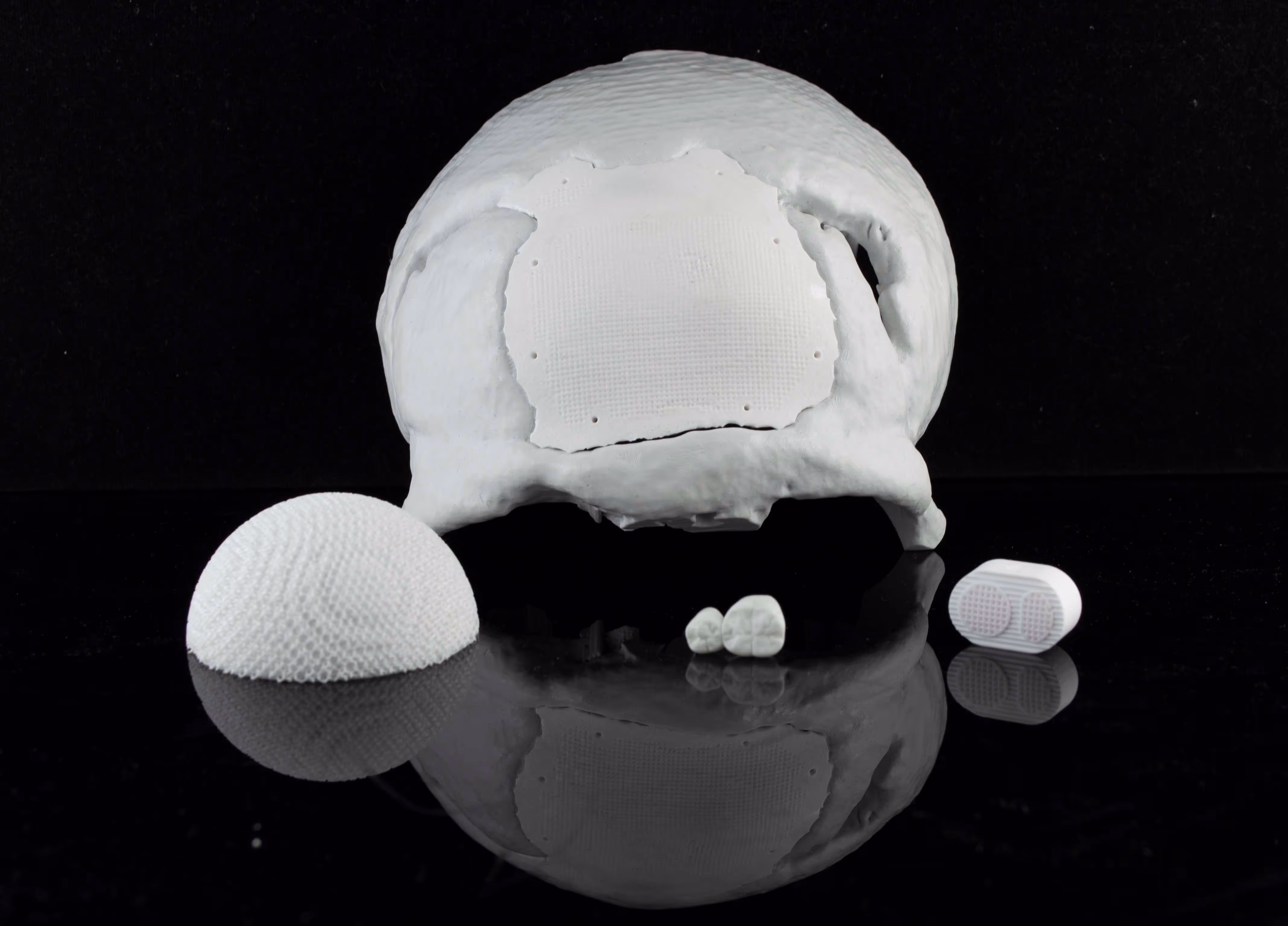 White 3D-printed biomedical implants including a skull section with a fitted implant and three smaller scaffold structures on a reflective black surface.