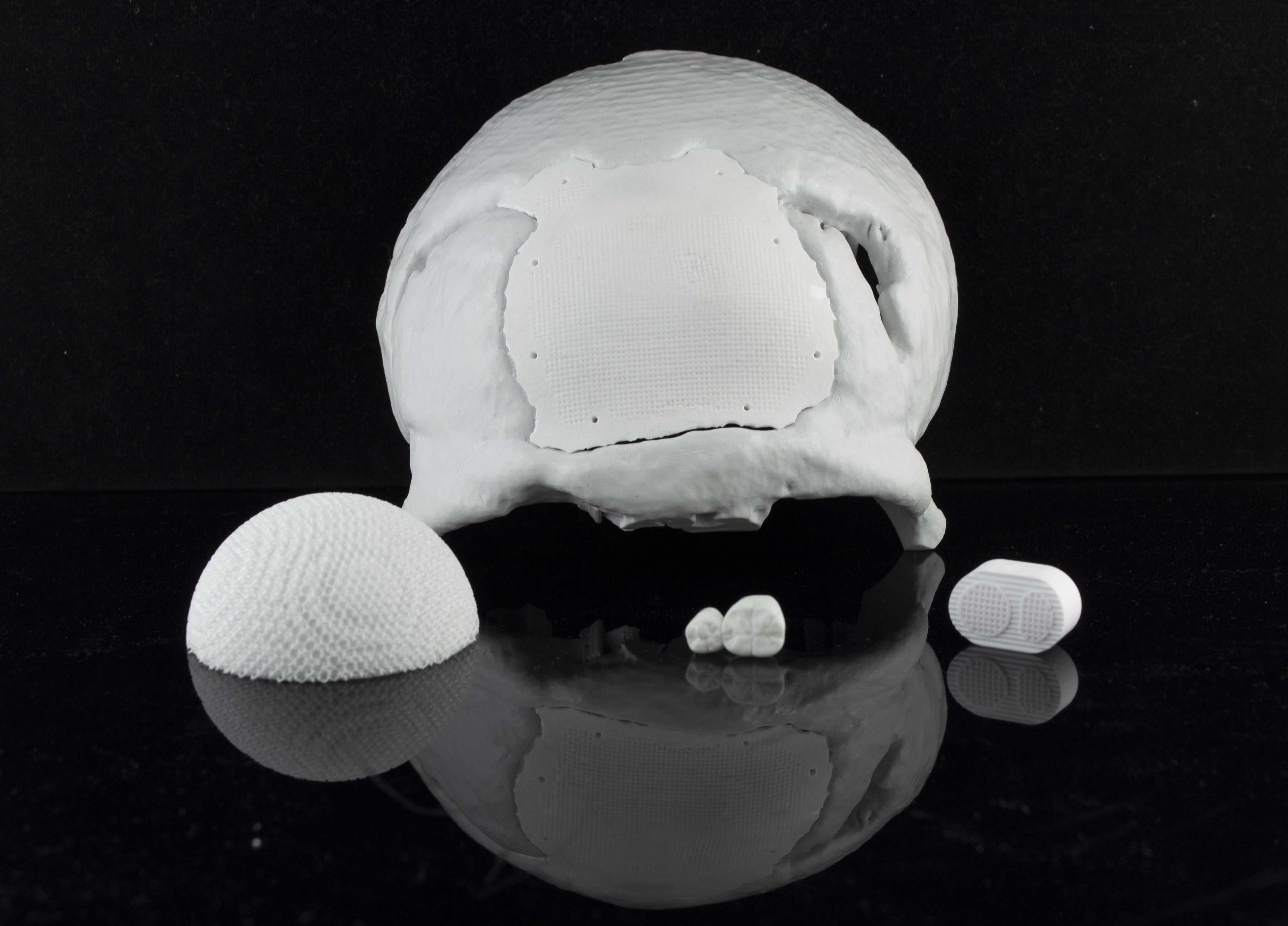 White 3D-printed biomedical implants including a skull section with a fitted implant and three smaller scaffold structures on a reflective black surface.