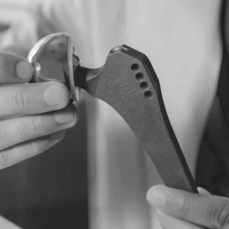 Person holding a hip implant device showing the metal ball and textured stem with screw holes.