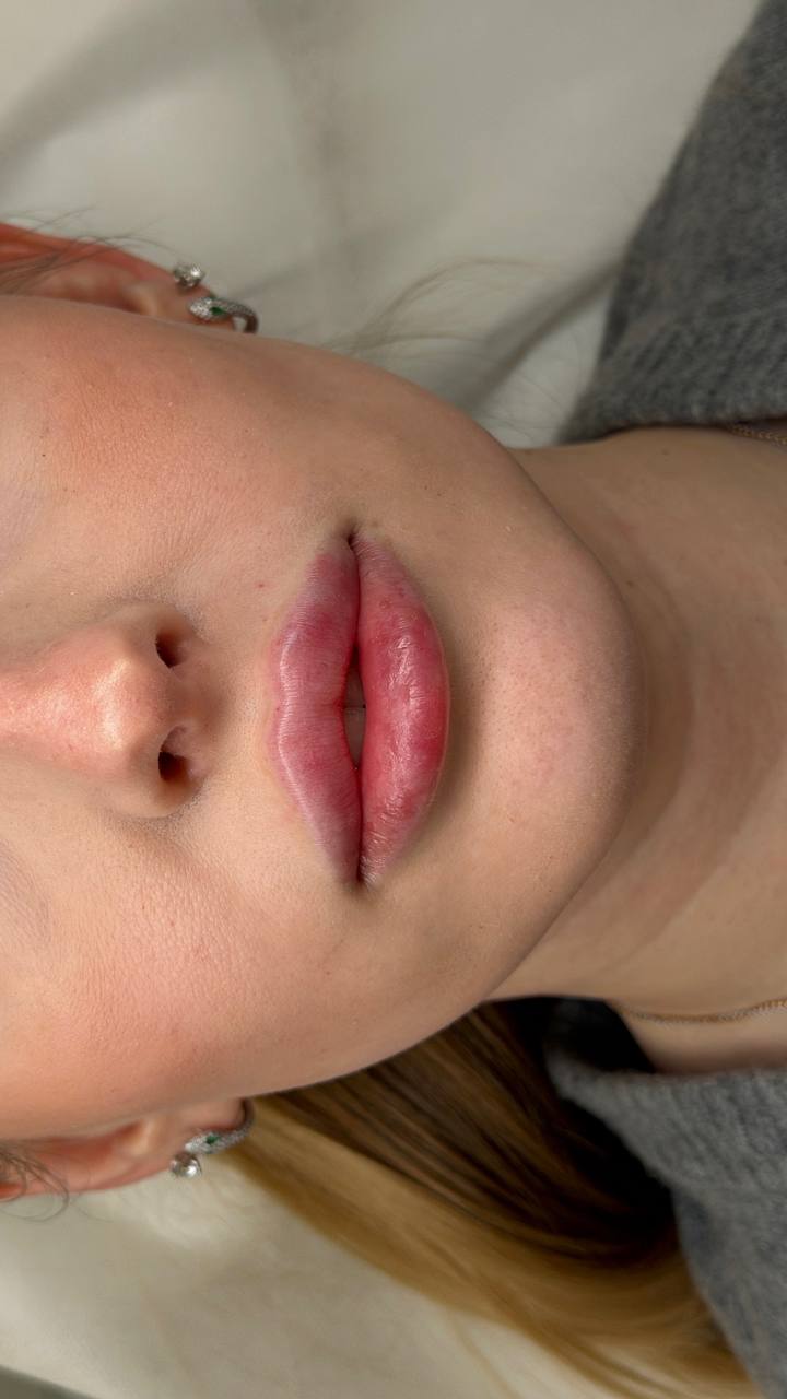 Instagram — Lumea Clinic