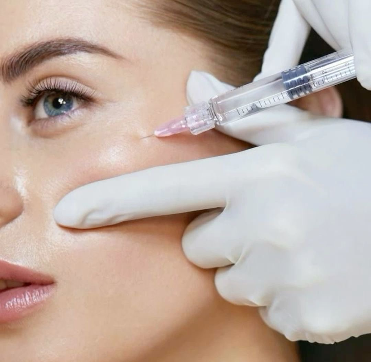 Biorevitalizace pleti v oblasti tváře