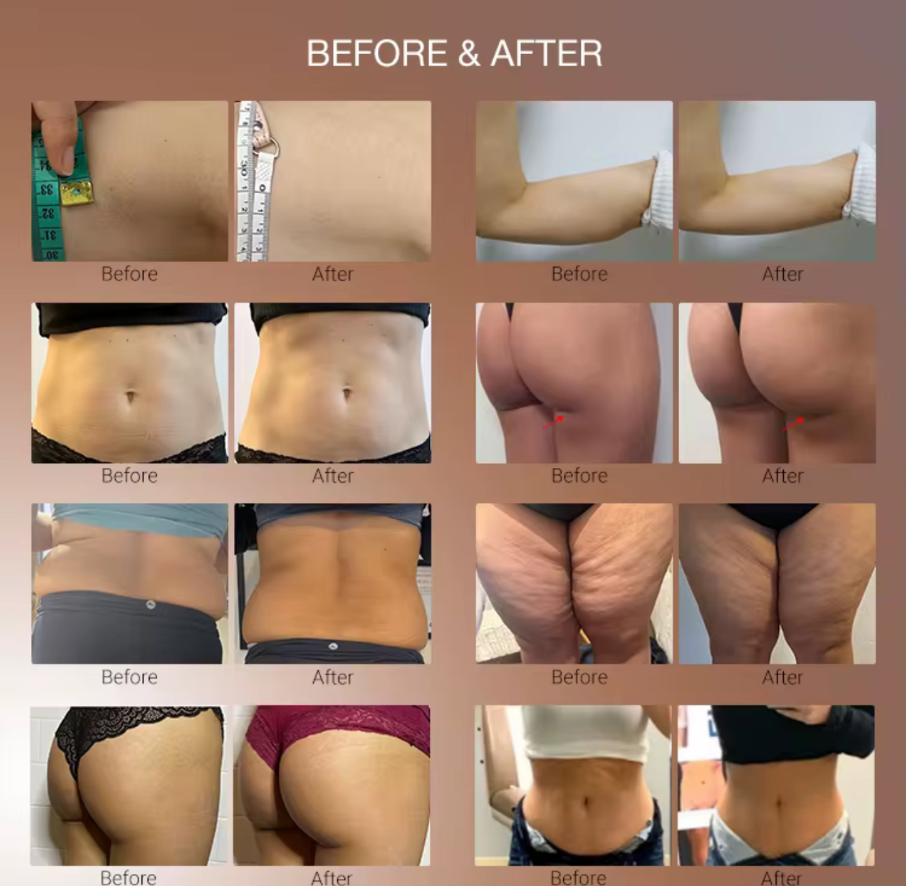 Renasculpt before & after
