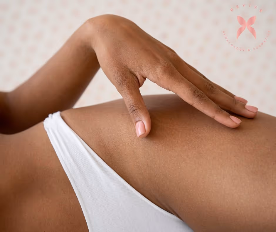 Intimate Bleaching in Marlton, NJ