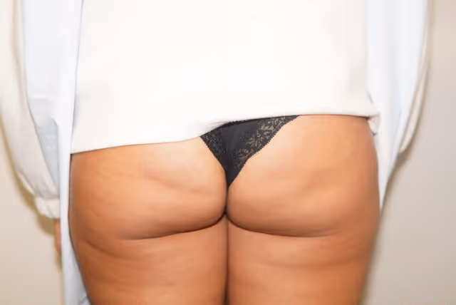 Before Aveli 2