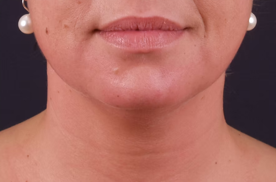 OAK Oakham Aesthetics Klinic