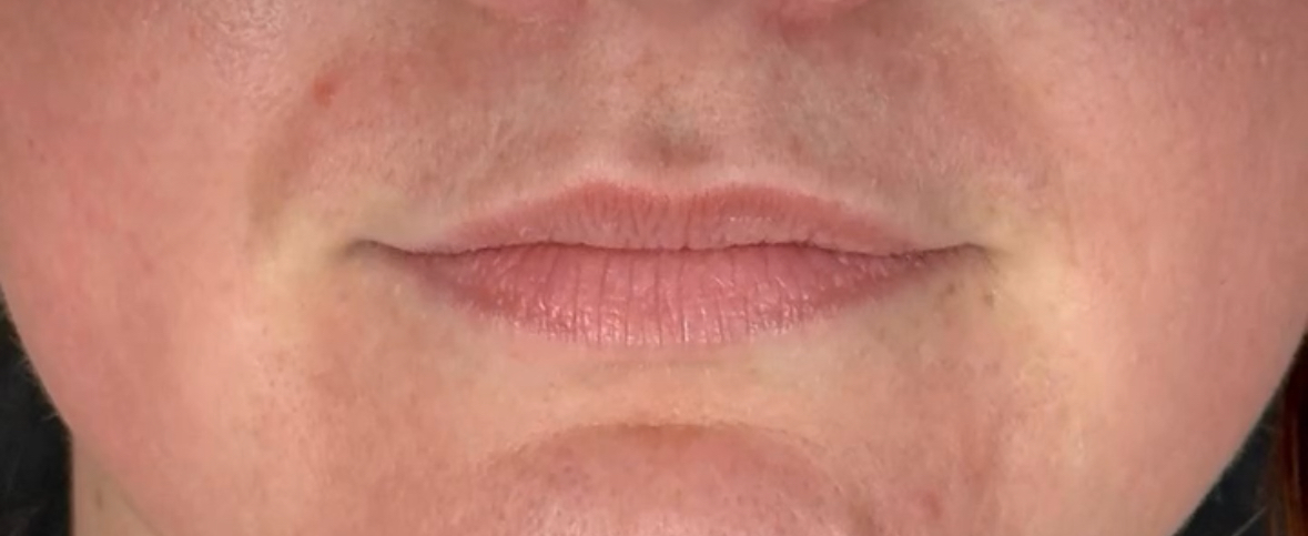 OAK Oakham Aesthetics Klinic