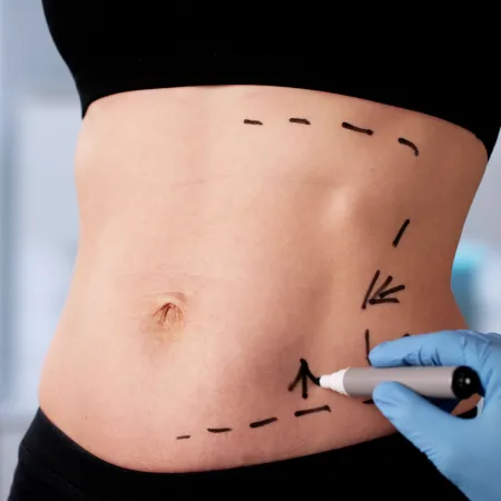 health-wellness-case-study-image