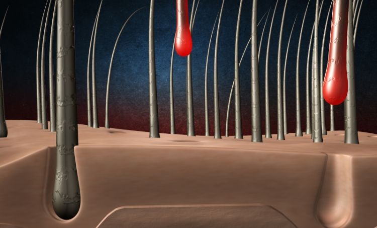 Close-up on hair roots, where roots are being pulled up. 