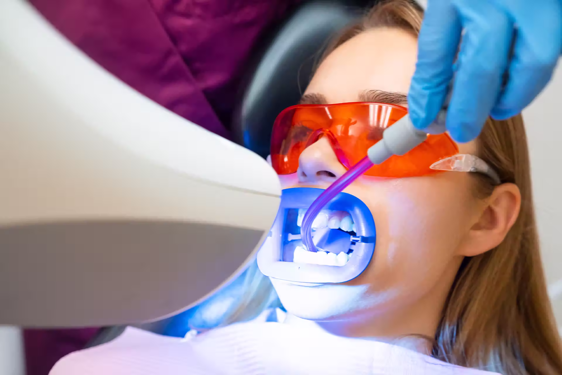 Teeth Whitening Coffs Harbour