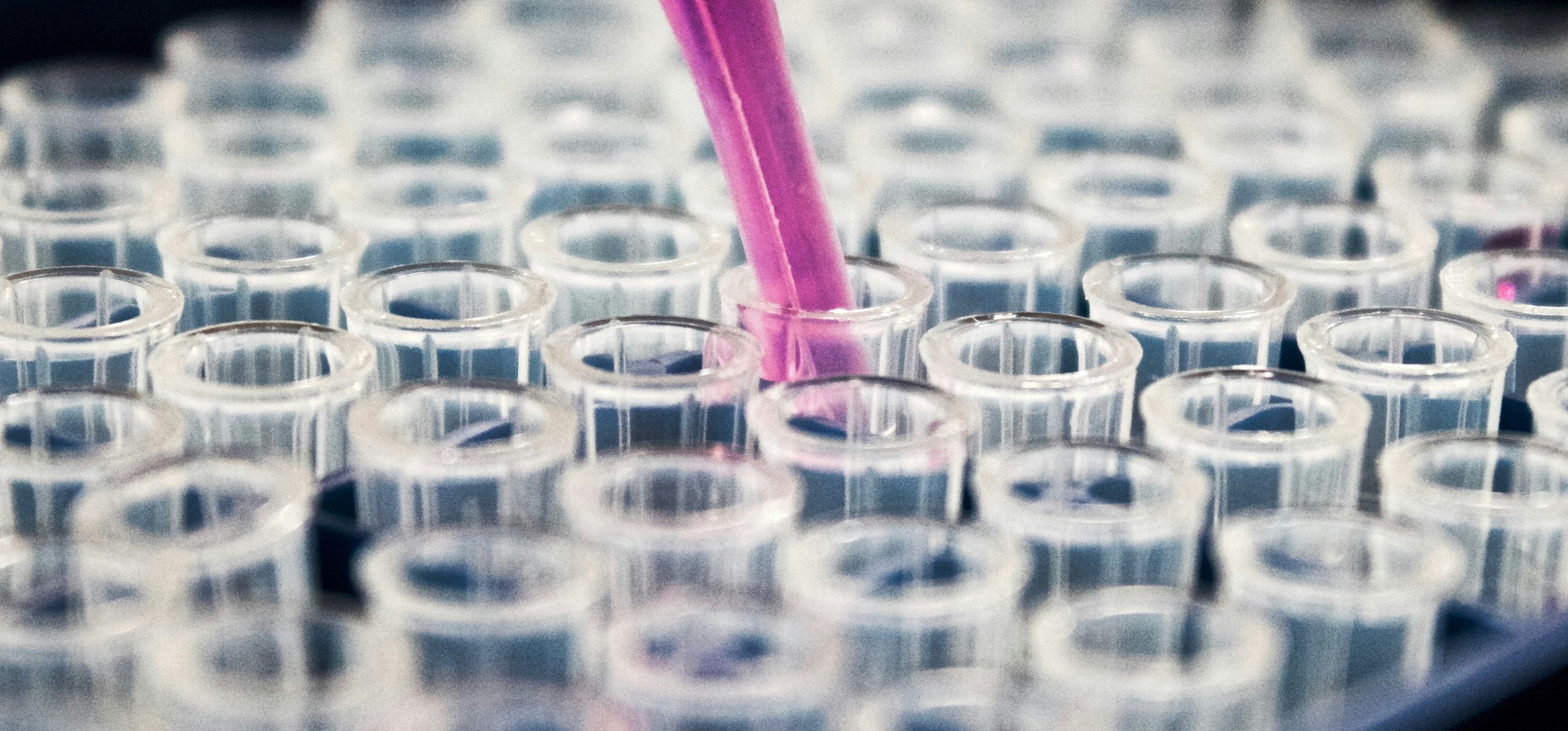 Blog post cover image