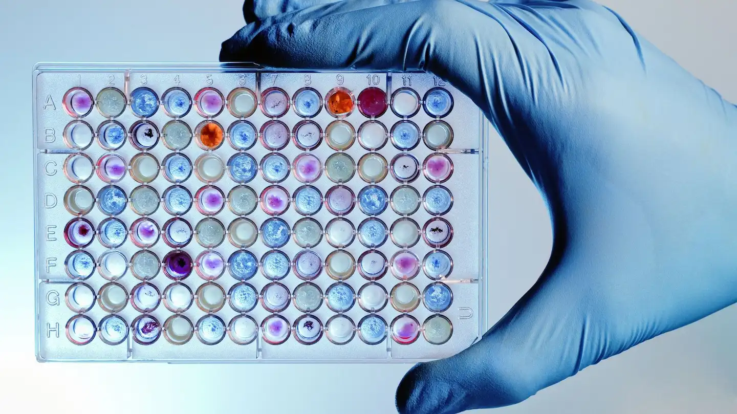 In 2017, a pharmaceutical company specializing in rare diseases asked Speyside to support and strengthen Patient Advocacy Groups (PAGs) in Brazil, which at the time operated in isolation and lacked coordination. Speyside conducted surveys and interviews to identify weaknesses and training needs, later organizing a webinar on regulatory processes and a hands-on workshop on public policy and advocacy. As a result, PAGs aligned on shared advocacy goals for 2018 and developed a roadmap for joint action—laying the foundation for a stronger, more unified rare disease advocacy network in the country.