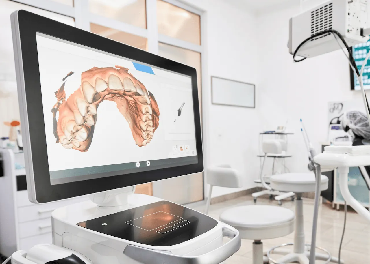 An image of a digital display showing the scan of a patients mouth for fitting same day crowns