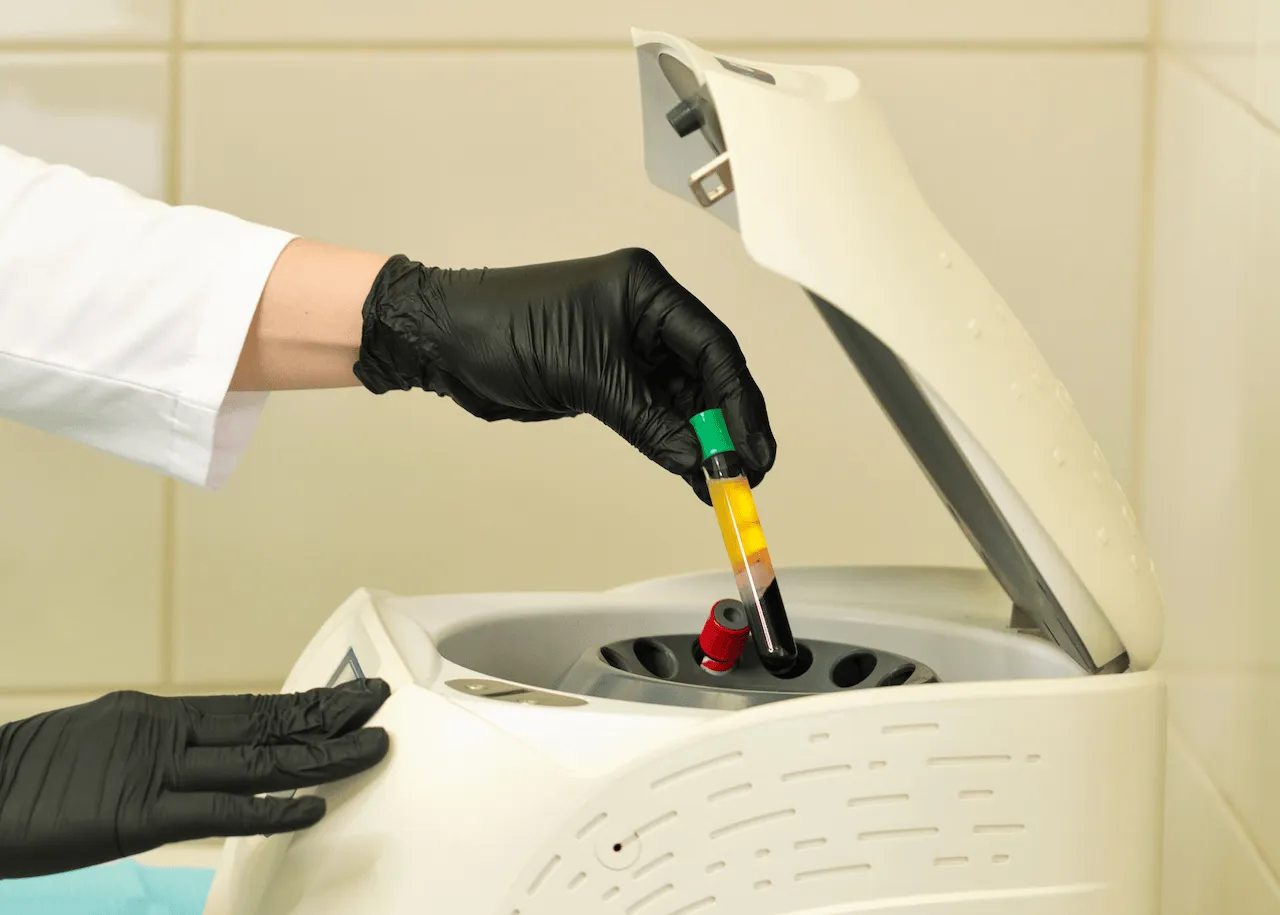 A clinician placing a blood vial with platelet-rich fibrin (PRF) into a centrifuge, commonly used in regenerative dental treatments.