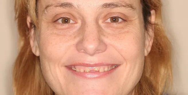 Close-up of a smiling woman with light brown eyes and light brown hair against a neutral background.