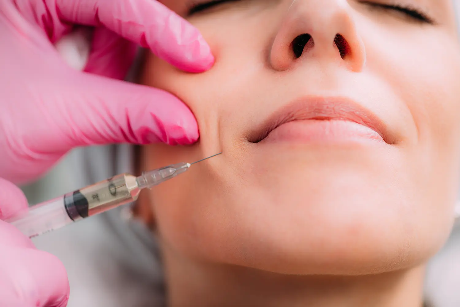 Botox in Vienna, VA | SmileWorx