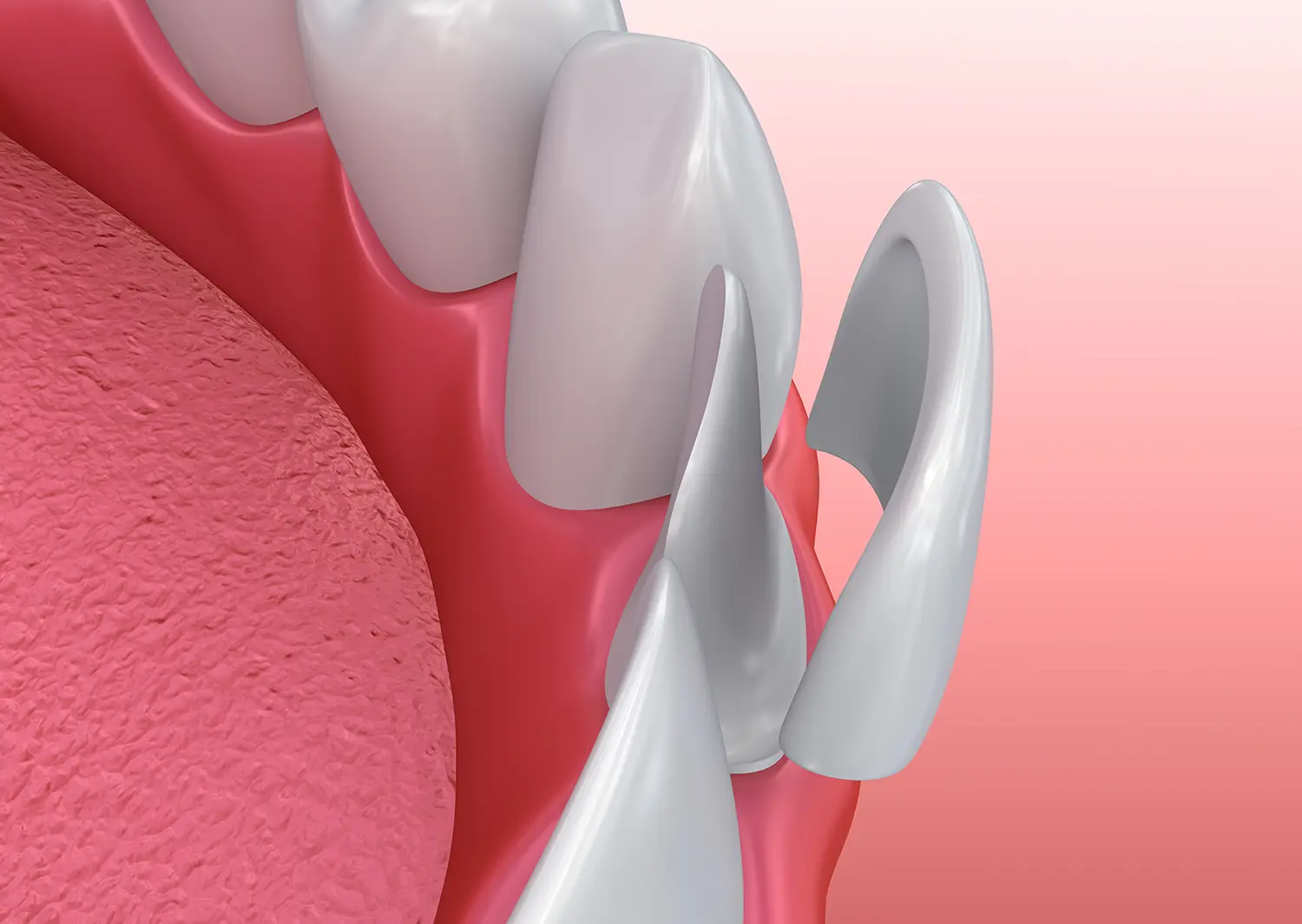 A dental model of a tooth and a dental tool.