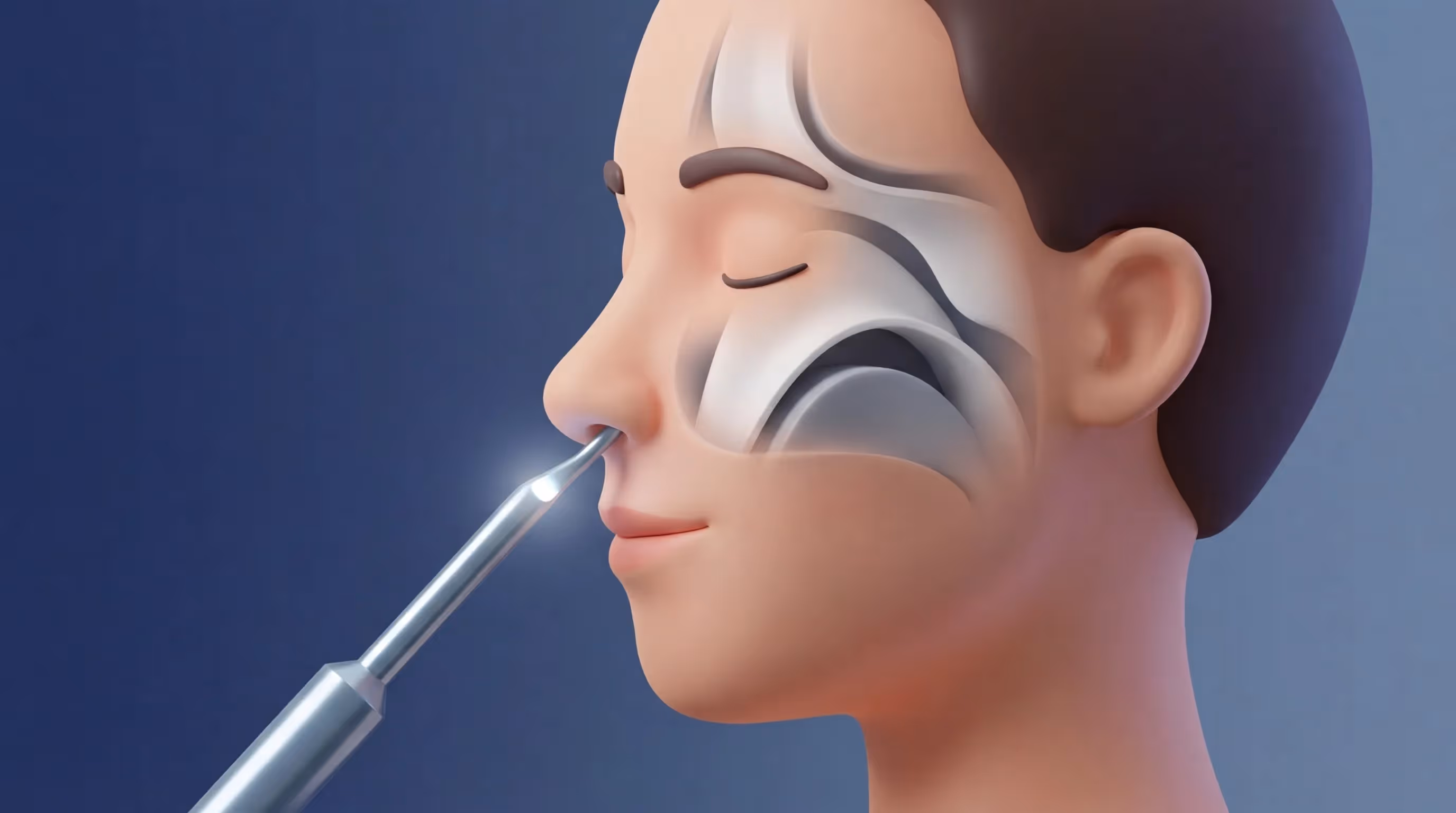 Nasal Endoscopy Procedure: Step-by-Step Guide, Benefits, and What to Expect