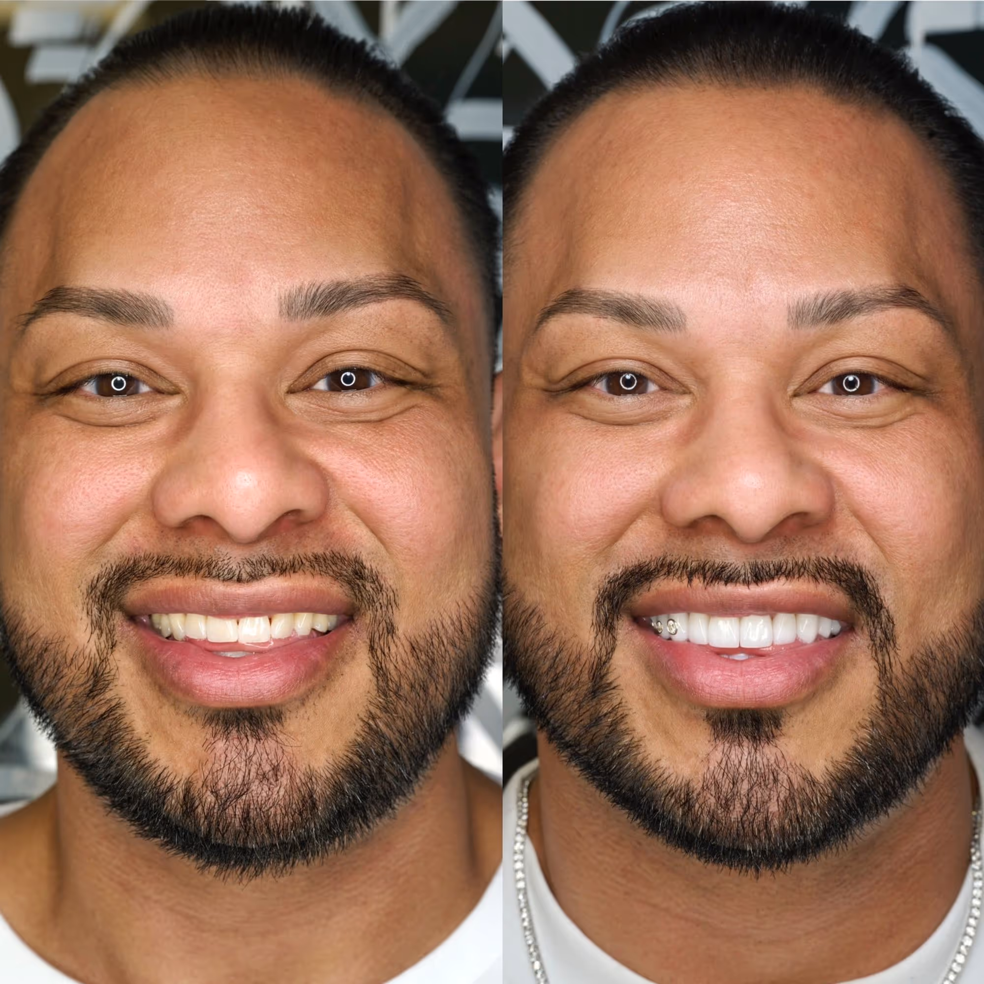 before and after