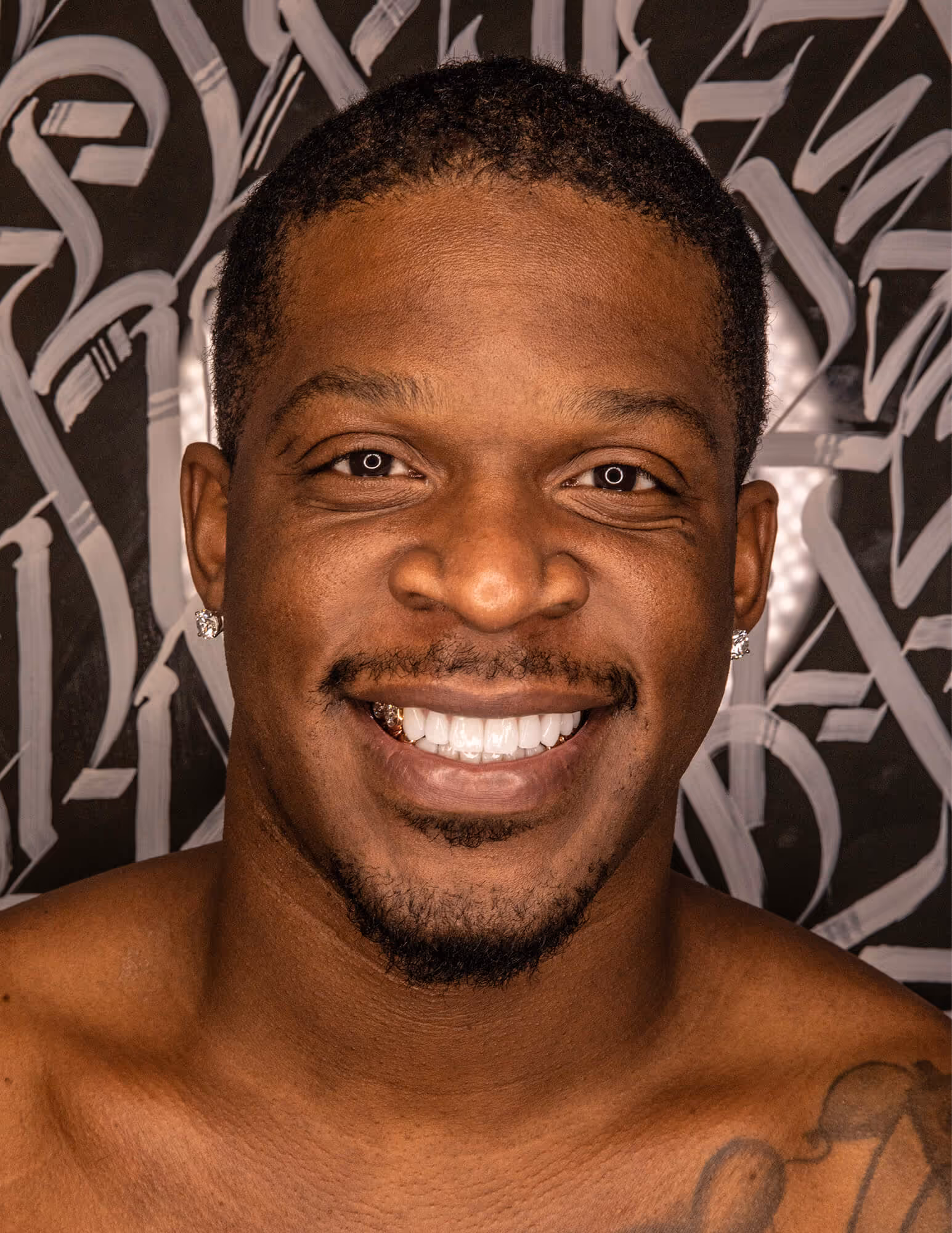 Smile Makeover