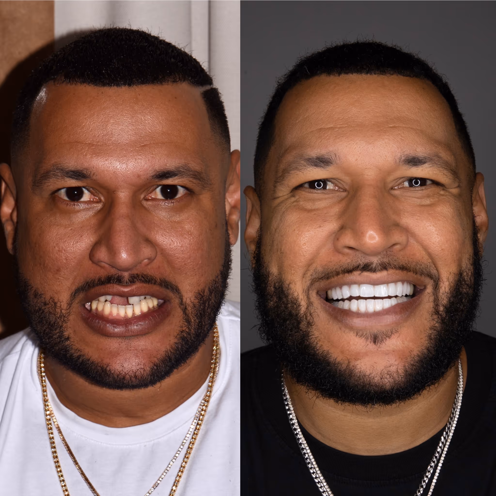 before and after