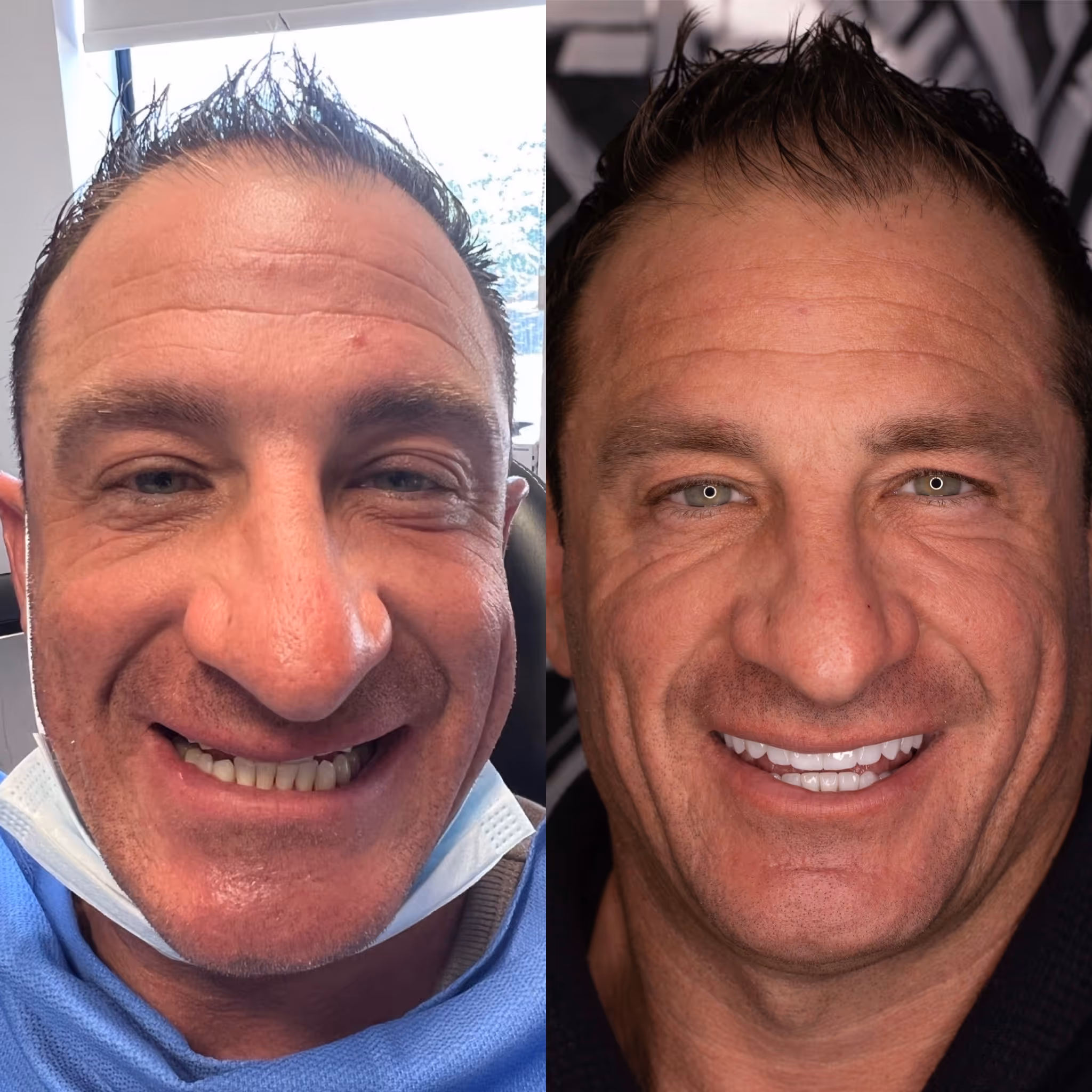 before and after