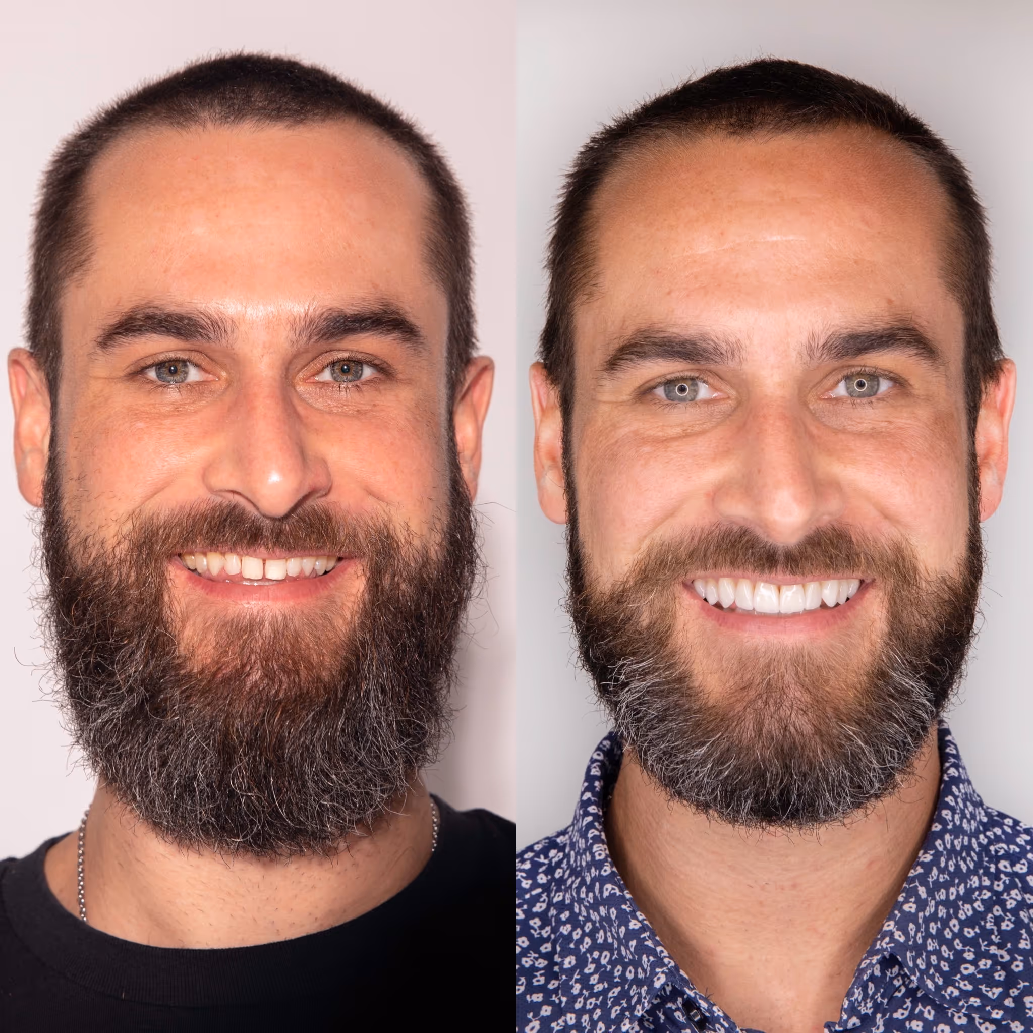 before and after