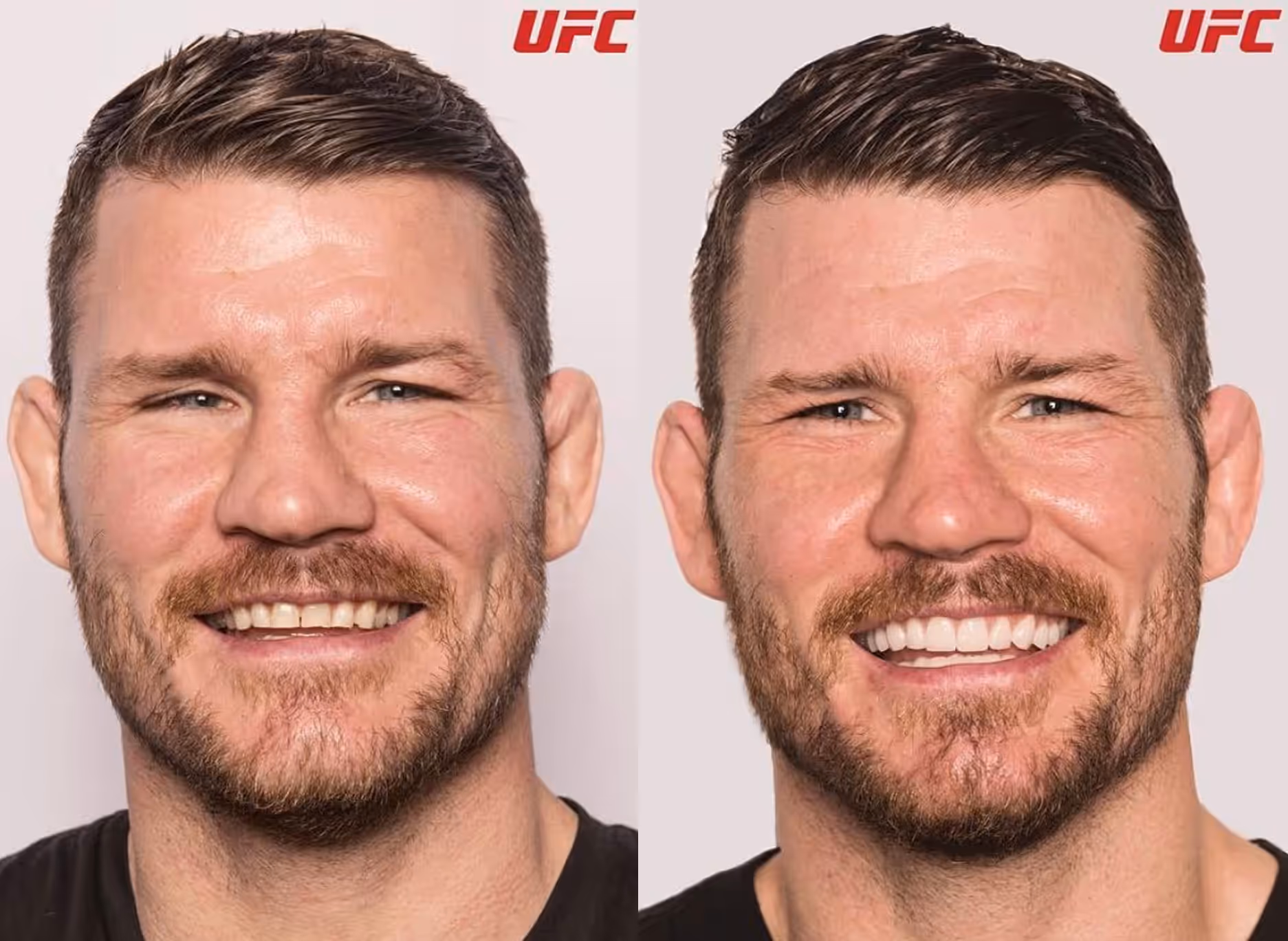 before and after