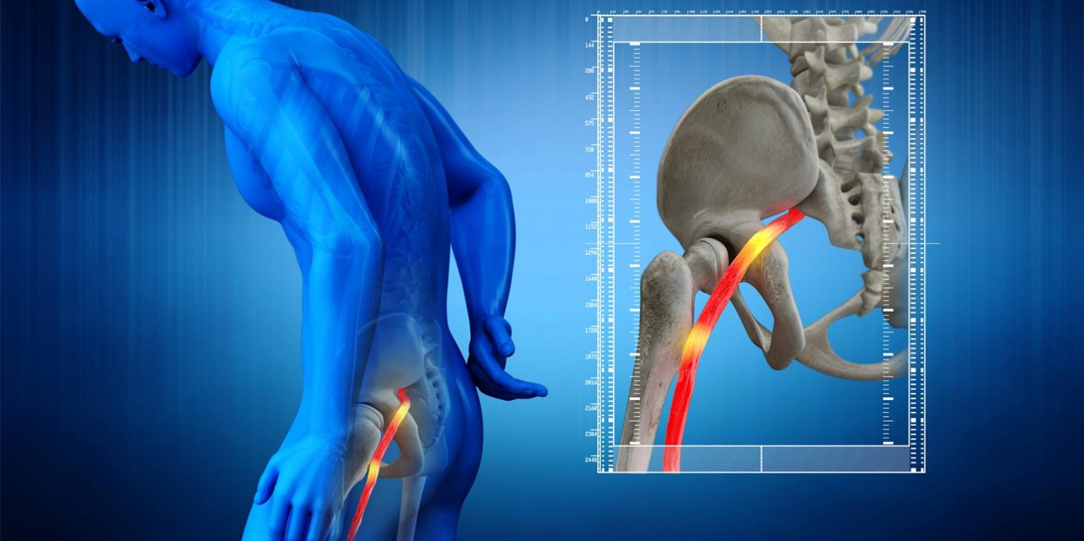 Bol u Donjim Leđima i Duž Noge: Šta je to i Kako Masaža Može Pomoći