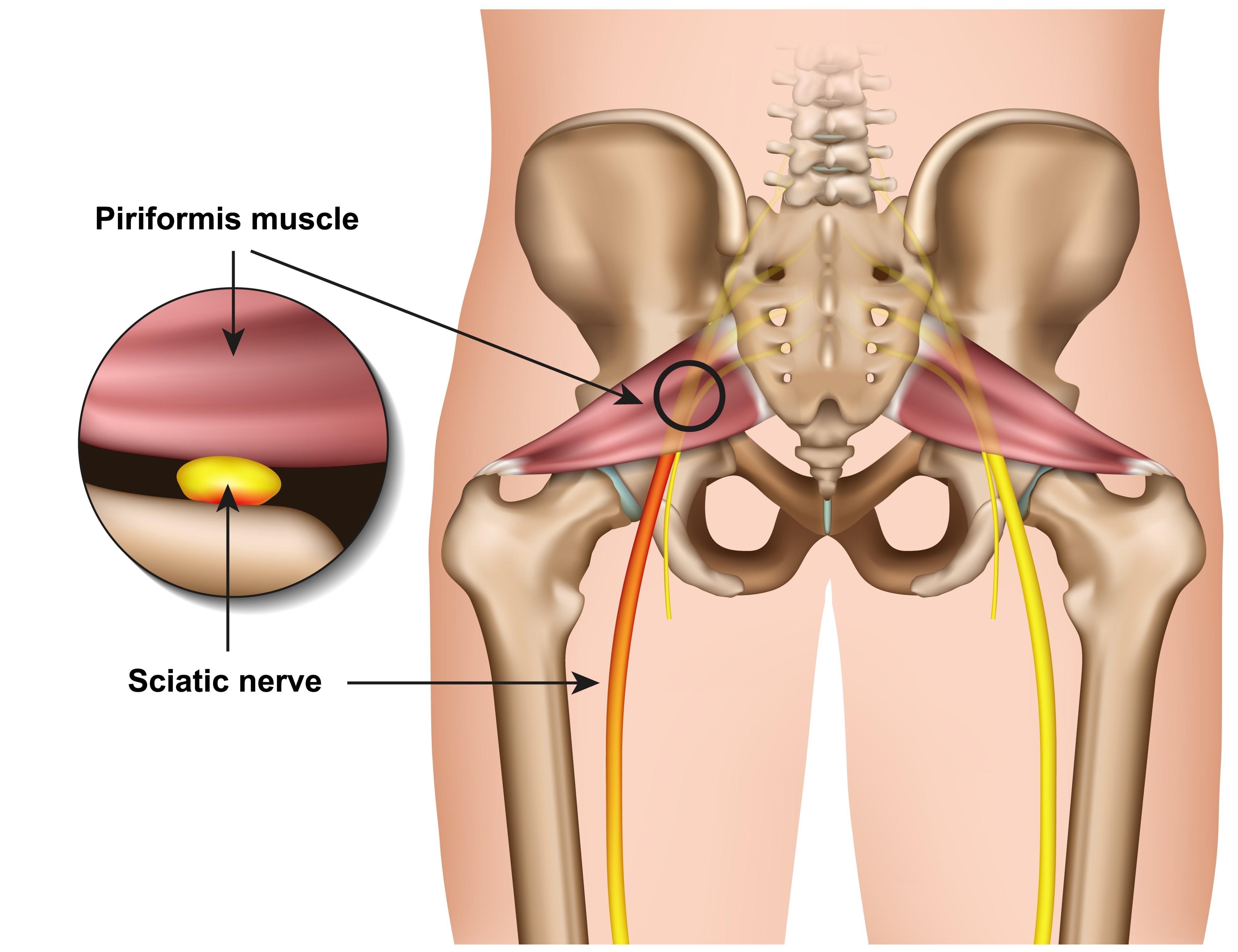 Image of sciatic nerve anatomy piriformis muscle