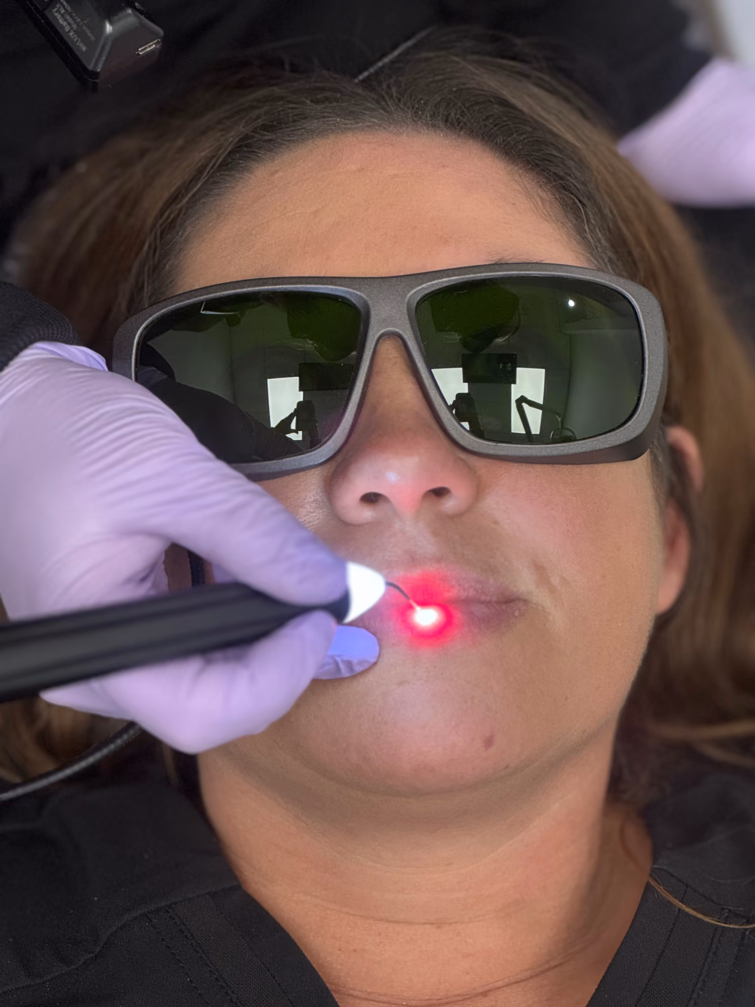 Laser Dentistry in Valparaiso, IN | Dunes Dental Studio