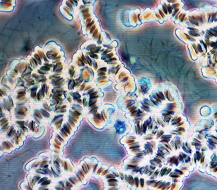 Microscopic view of multiple segmented, coiled chromosomes stained in dark and light shades against a bluish background.