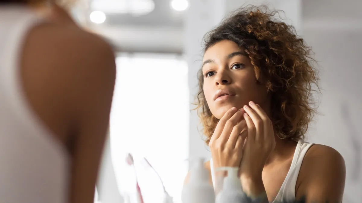 5 Tips for Acne Prevention