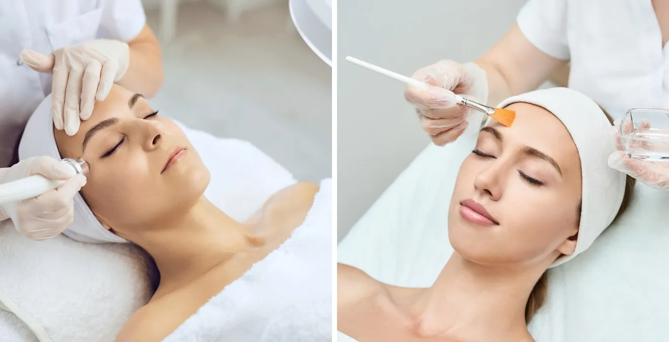 Exploring the different Types of Peels-Which is right for me?