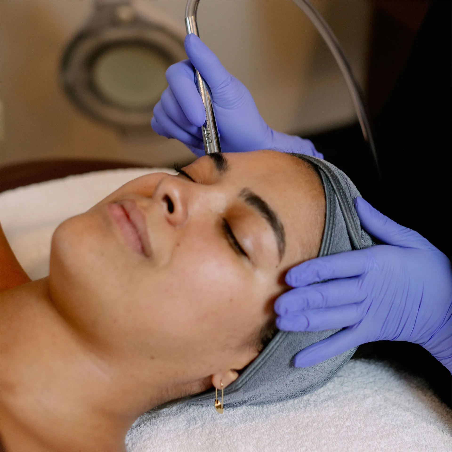 Renew Microdermabrasion