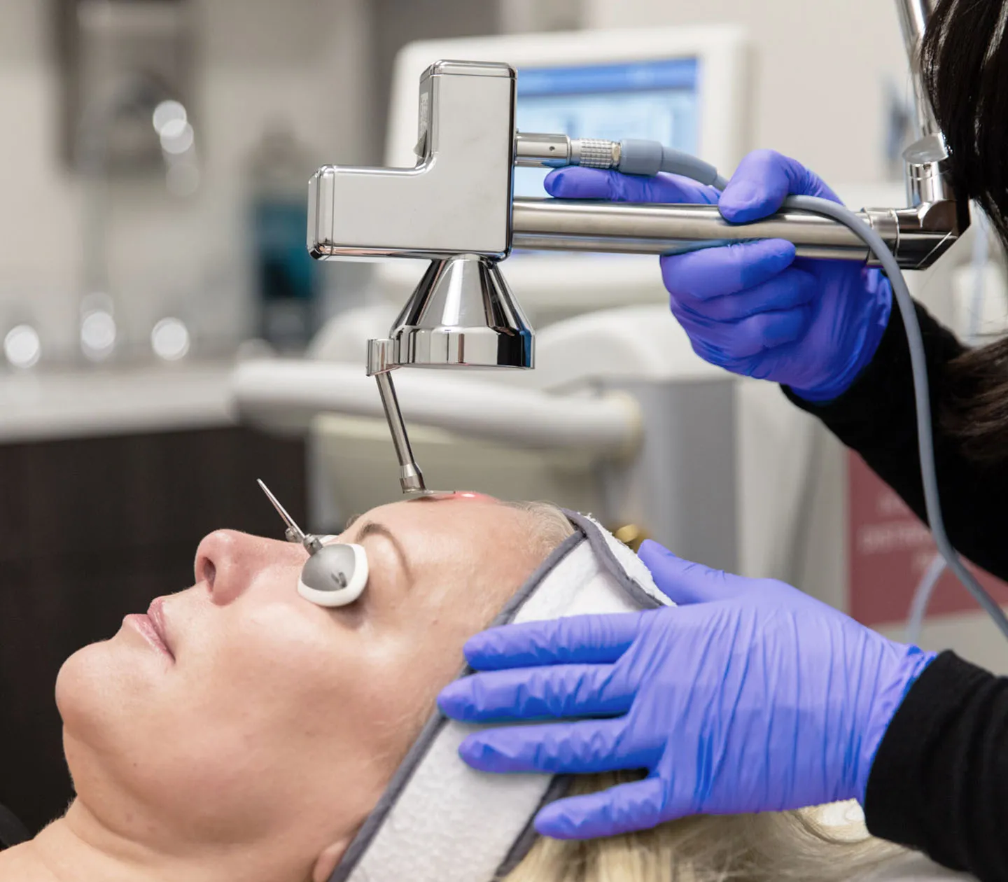 MicroLaser Peel