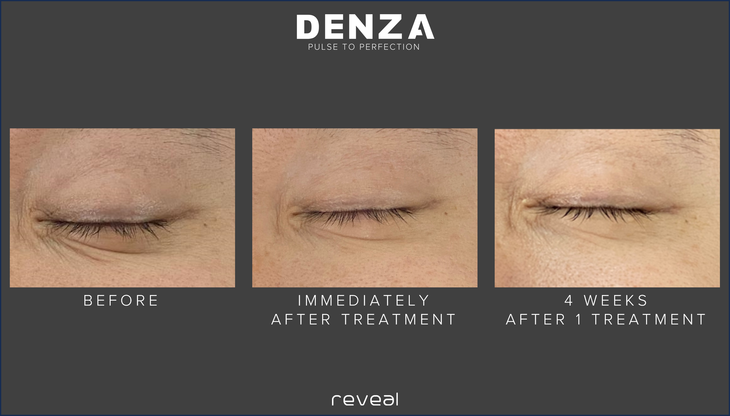 Before and After Images