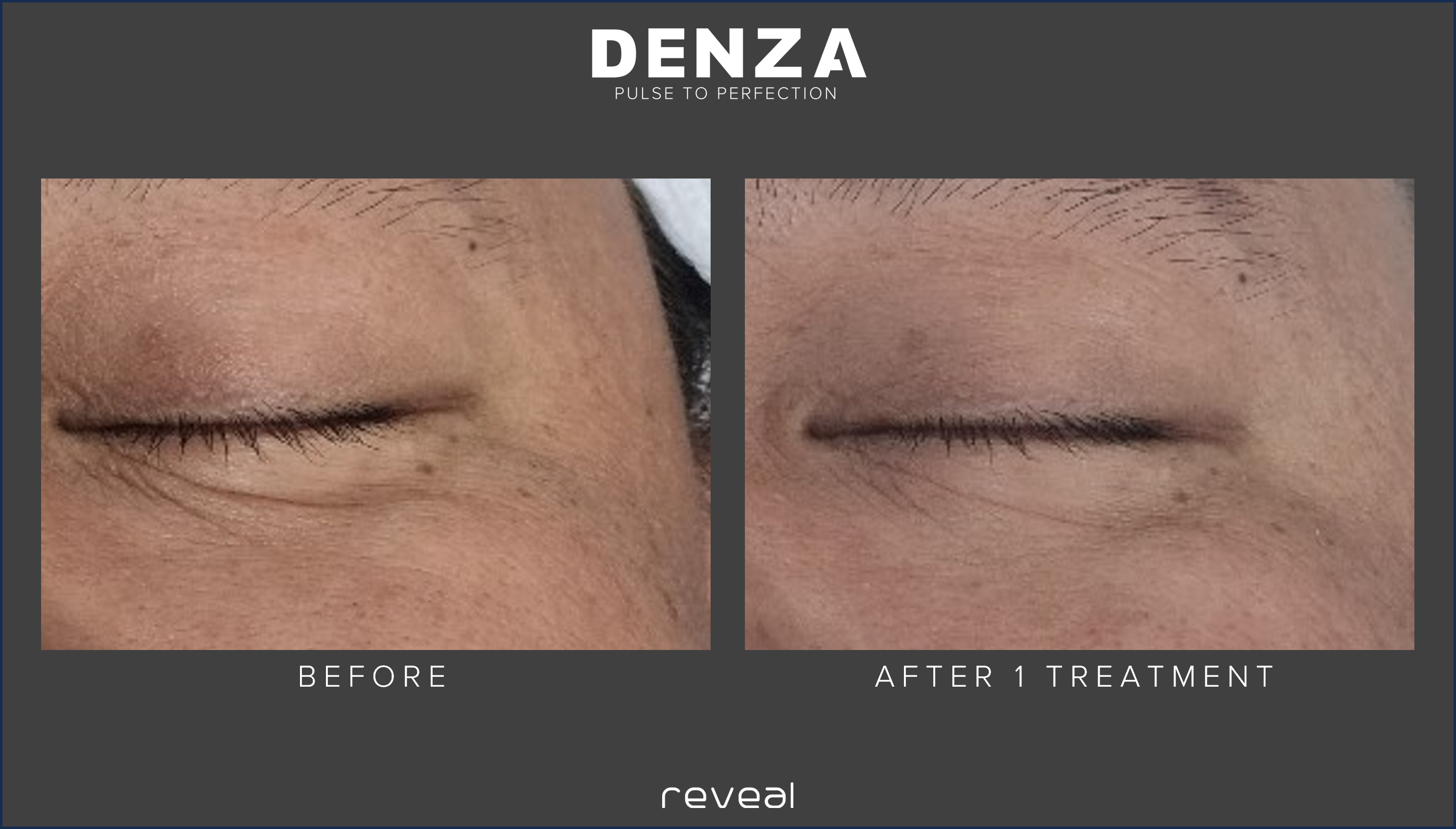 Before and After Images