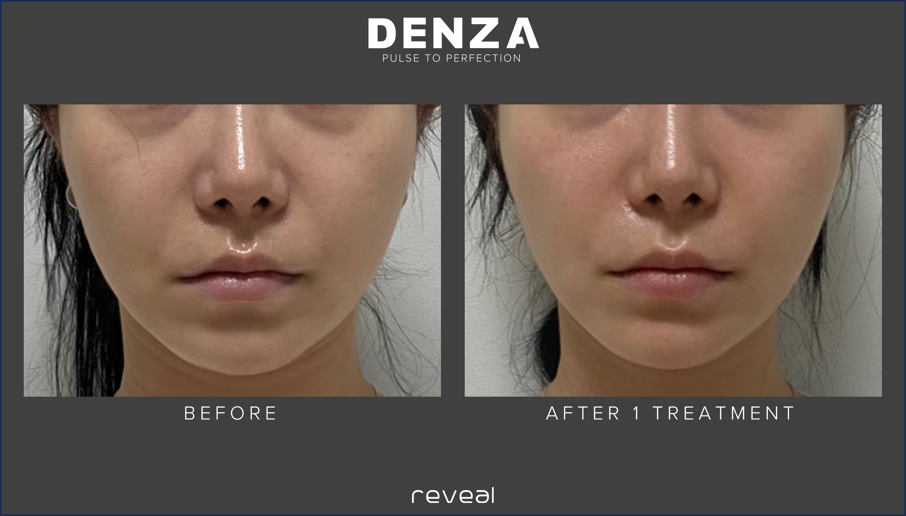Before and After Images
