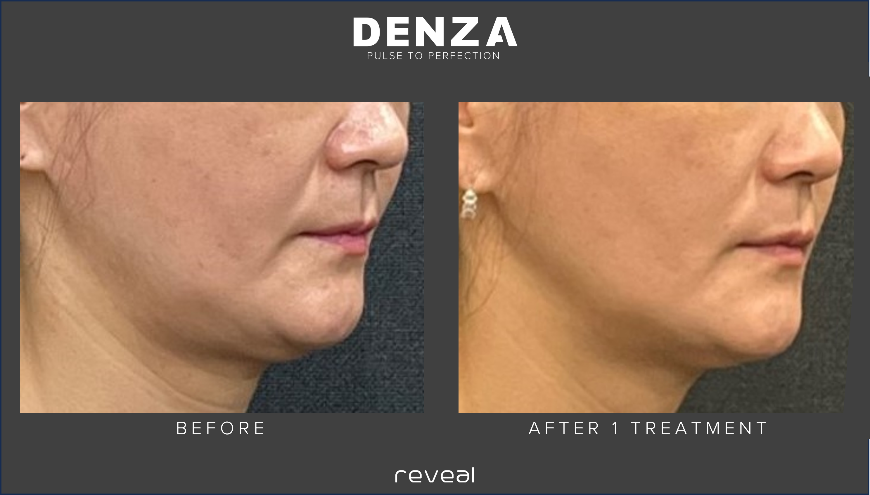 Before and After Images