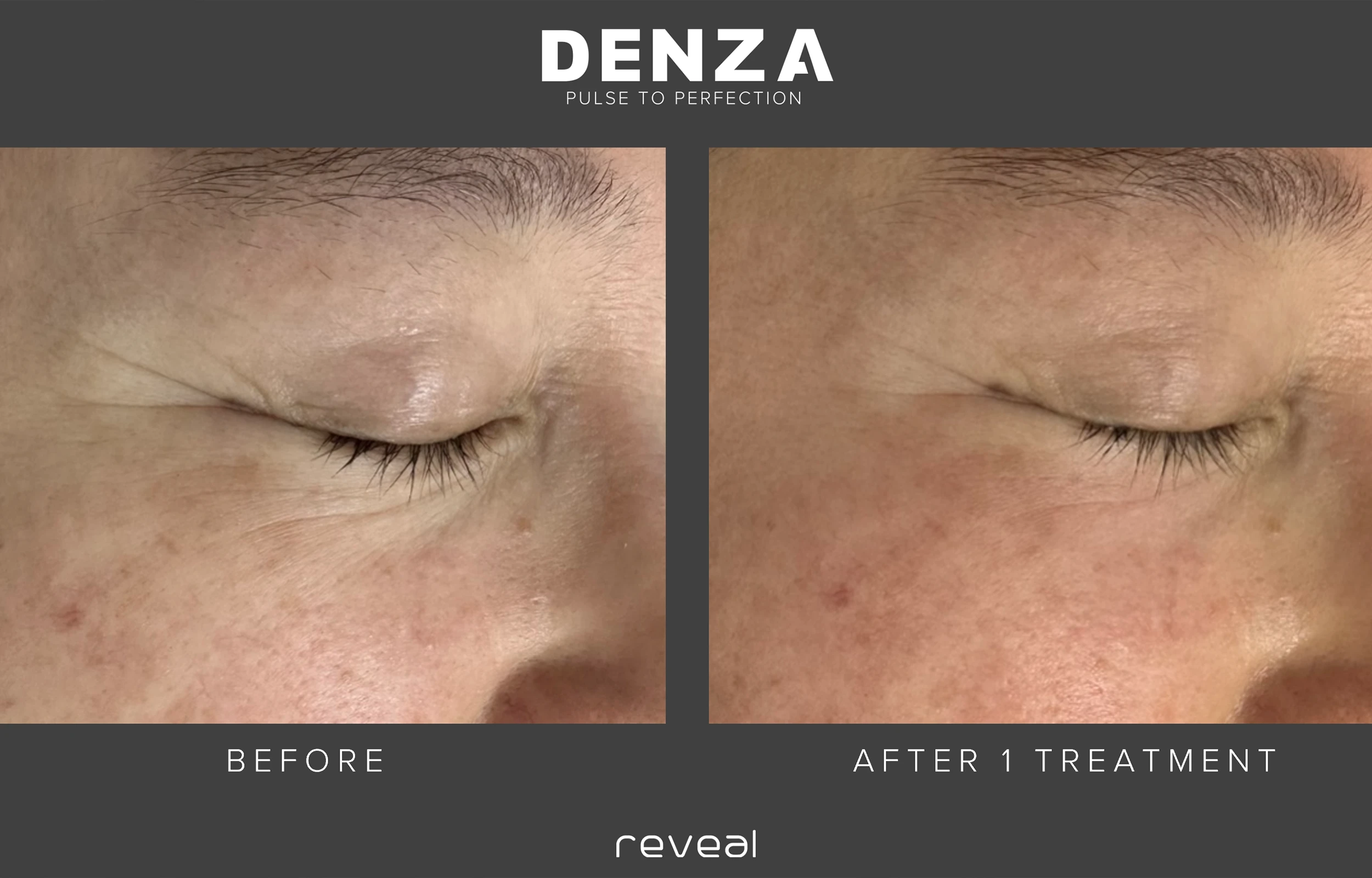 Before and After Images